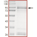 EGFR (D746-750 G724S), Active